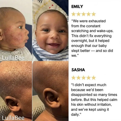 LullaBee™ - Stop Baby's Eczema Itch From Night One For Uninterrupted Sleep